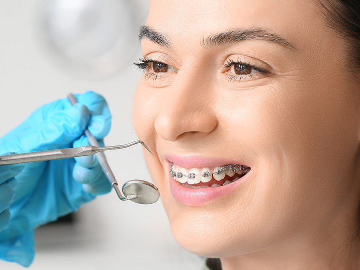 Dental Implants
